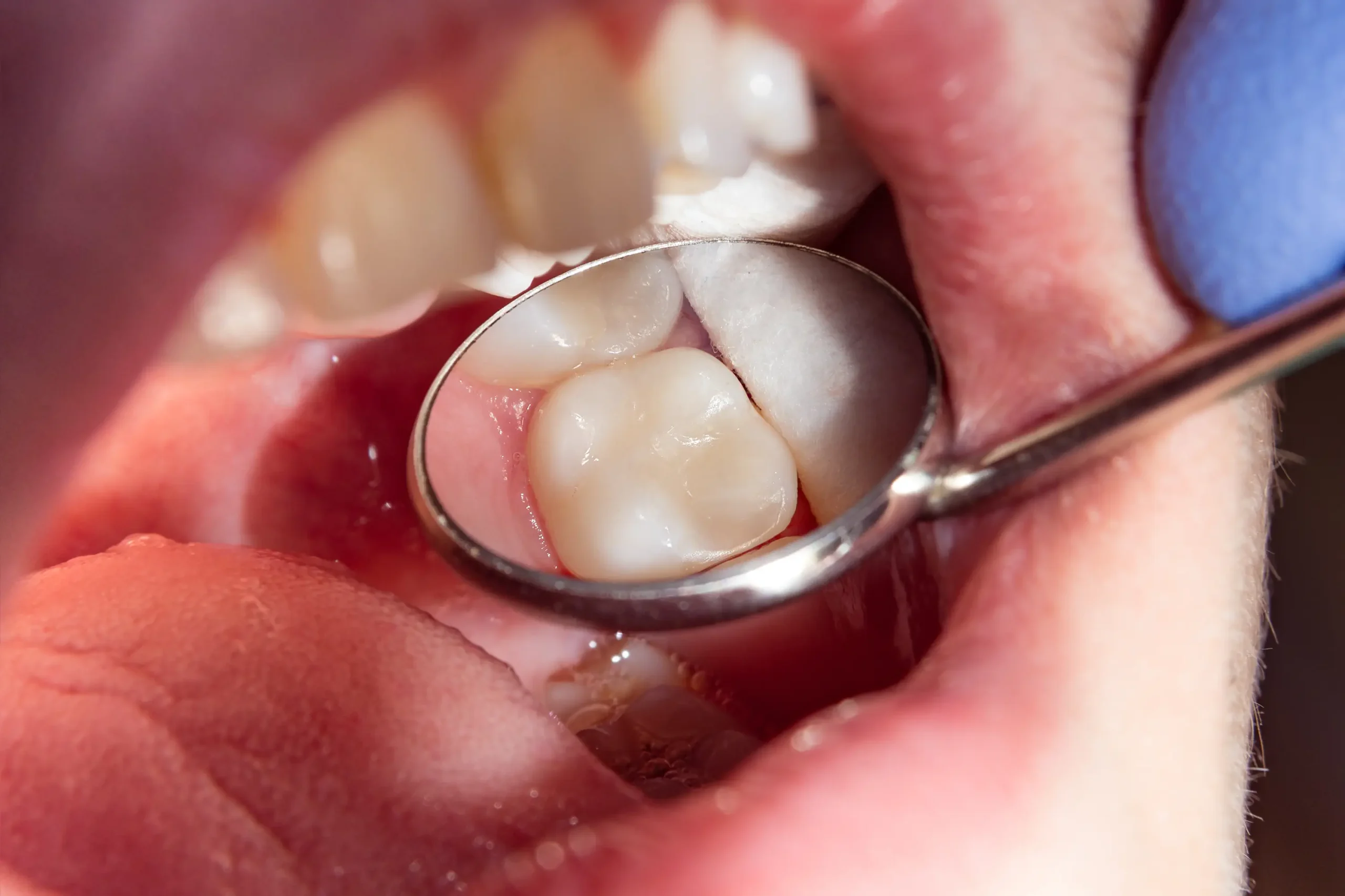 Biomimetic dentistry