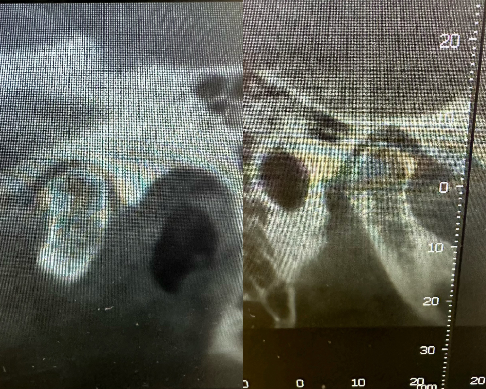 Jaw x rays